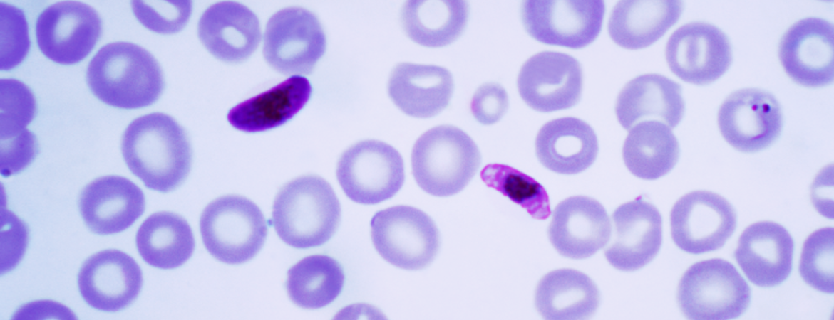 Genome structure of malaria parasites linked to virulence | Center for